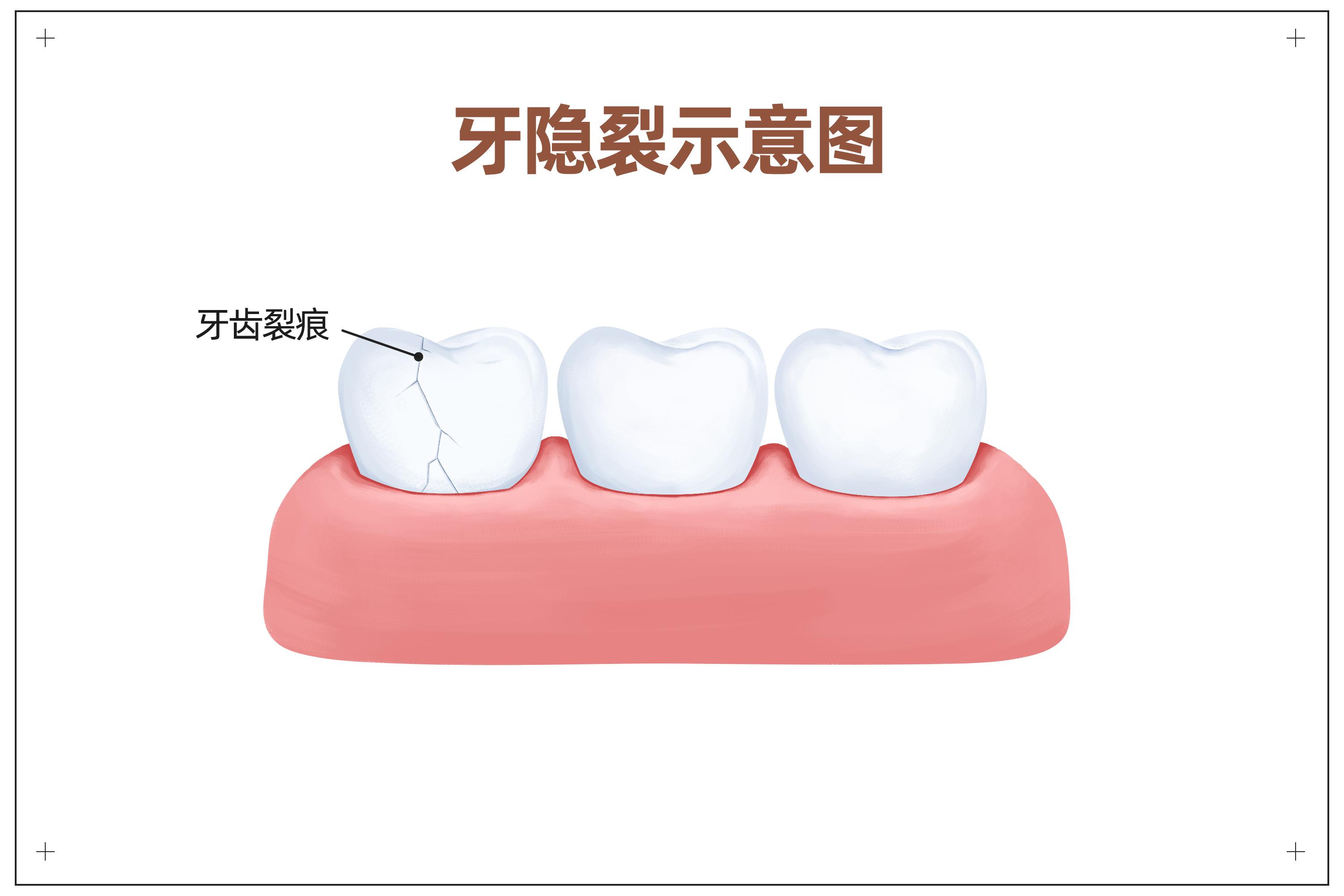 警惕口腔内的“隐形杀手”